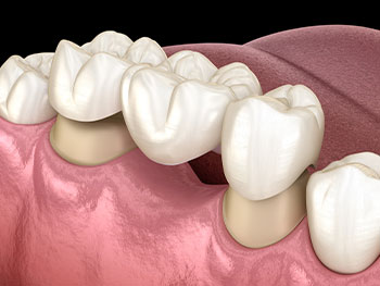 Conway Family Dental Care