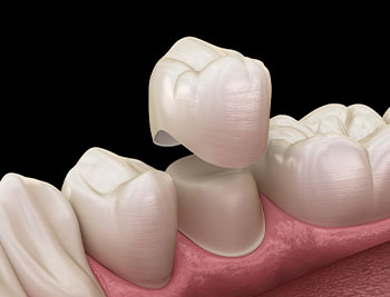 Conway Family Dental Care