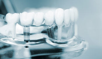 Conway Family Dental Care